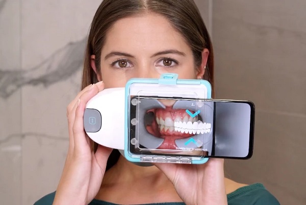 Dental Monitoring ScanBox pre diaľkové dentálne monitorovanie.