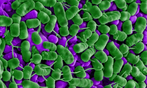 Baktérie Listeria (zelené) umierajú po expozícii plantacyklínu B21AG - hrčky viditeľné na mnohých bunkách sú obsahom bunky, ktorý začína unikať.