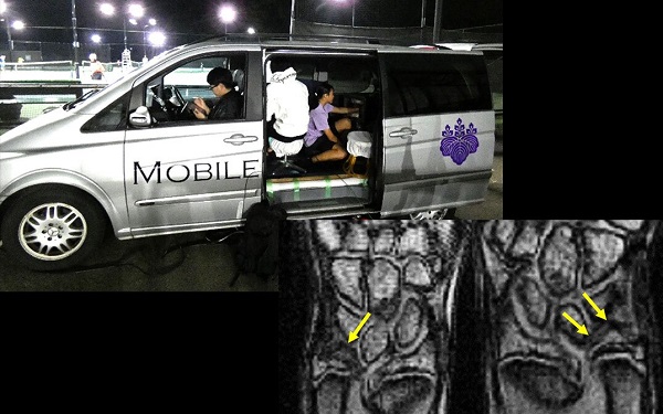 Študent tenisu si nechá naskenovať zápästie mobilným systémom MRI.