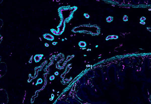 Krvné cievy vo vzorke ľudského ilea. Imunofluorescenčné farbenie zvýrazňuje endotelové bunky v purpurovej farbe, označené CDH5, a bunky hladkého svalstva v azúrovej farbe, označené ACTA2.