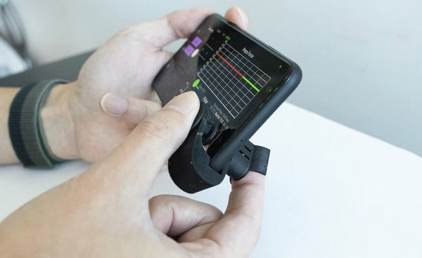 Zariadenie BPClip sa pripája k bežnému smartfónu a pomocou aplikácie meria systolický a diastolický krvný tlak.