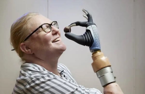 Karin predv&aacute;dza &scaron;ikovnosť svojej bionickej ruky Mia Hand.