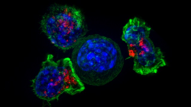 T bunky obkľúčili rakovinovú bunku (Zdroj: Wikimedia Commons).