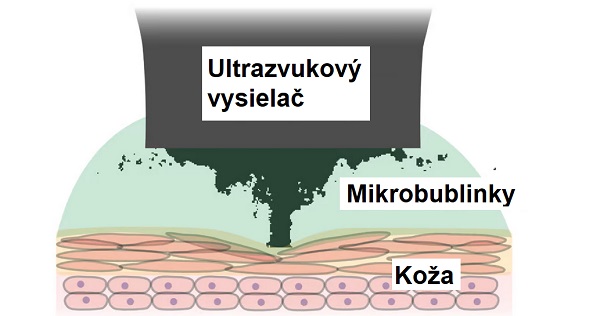 Schéma znázorňujúca proces spojenia hydrogélu s kožou.