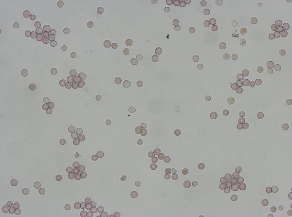 Mikroskopická snímka šarže červených krviniek kultivovaných na klinické testy.