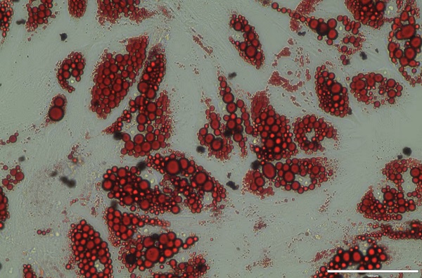 Ľudské hnedé tukové bunky možno vidieť v červenej farbe.