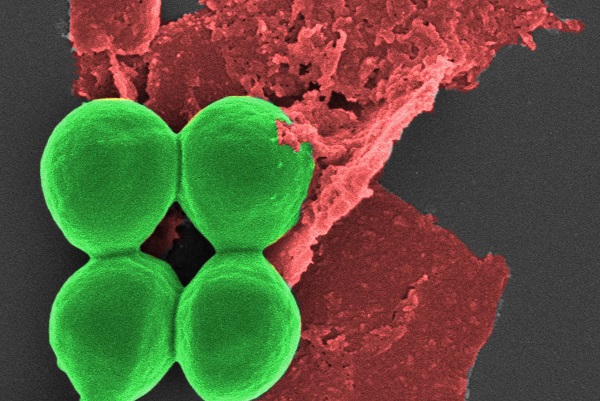 Vedci použili nanovločky čierneho fosforu (červené) na ničenie baktérií (zelené).