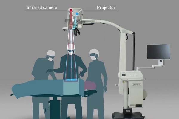 Infračervený projekčný systém Medical Imaging Projection System (MIPS).