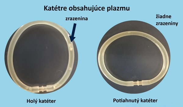 Neošetrená slučka katétrovej hadičky (vľavo) spolu so slučkou s aplikovaným povlakom bez zrazeniny.