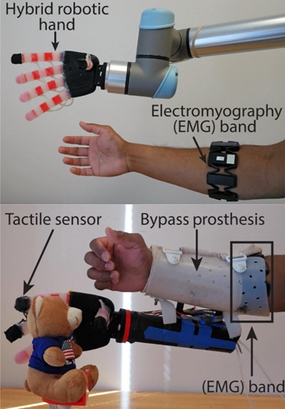 Robotická ruka sa ovláda pomocou elektromyografických signálov cez zariadenie na ovládanie gestami (hore).