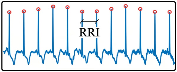 Na trénovanie modelu hlbokého učenia bol použitý R-R interval (RRI) zo štandardného EKG.