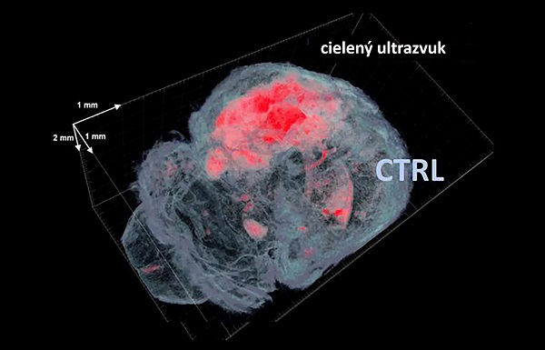 Výskumníci použili cielený ultrazvuk na neinvazívne otvorenie hematoencefalickej bariéry (červená) u myší.