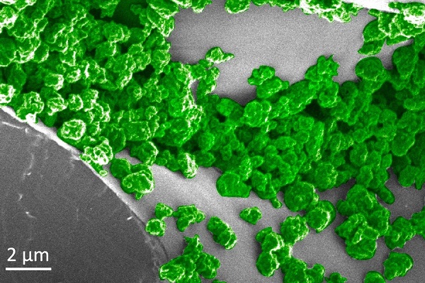 Mikroskopický obraz žiariacich nanočastíc (zvýraznených zelenou farbou) vo vnútri rastliny.