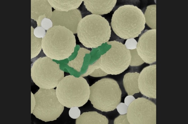 Na snímke z mikroskopu sú mikroroboty (žltá) spolu s uväznenými baktériami (zelená) a malými kúskami plastu (biela).