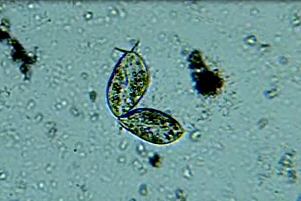 Pár organizmov Paramecium aurelia pláva vo vzorke vody.