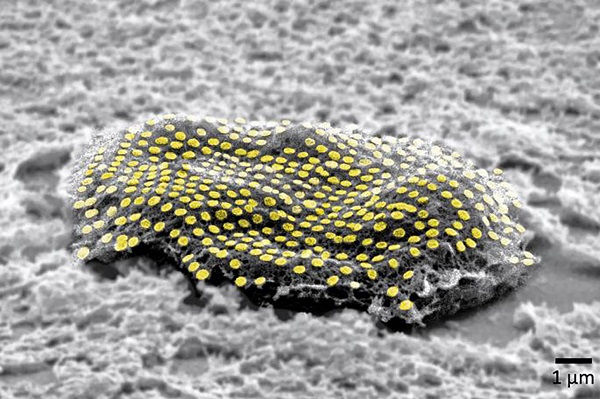Výskumníci vytvorili zlaté pole nanobodiek a pripojili ho k jednej fibroblastovej bunke.