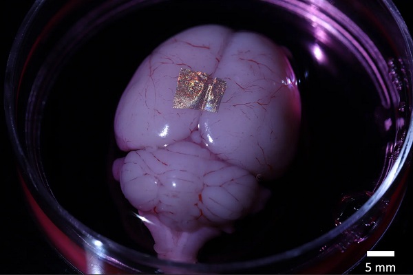 Nanodrôtové pole umiestnené na mozgu potkana.