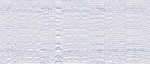 Ukážka EEG; každý mozog má svoju vlastnú jedinečnú frekvenciu oscilácie alfa vĺn niekde medzi 8-12 Hz.