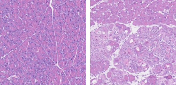 Normálne pankreatické bunky (vľavo) podliehajú preprogramovaniu (vpravo), keď sú posilnené vitamínom B12.