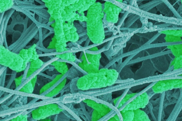 Snímka problematických baktérií Pseudomonas aeruginosa (zelená farba) v spojivových vláknach ľudskej kože v mieste chronickej rany nasnímané rastrovacím elektrónovým mikroskopom.