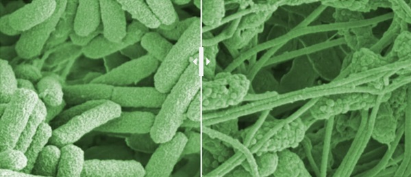 Baktérie Pseudomonas aeruginosa v mieste chronickej rany pred (vľavo) a po aplikácii obväzu.