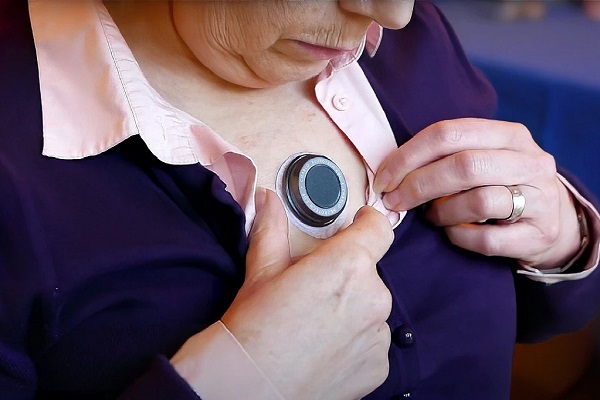Nositeľné zariadenie CUE1 s bzučiakom na hrudi môže pomôcť zmierniť príznaky Parkinsonovej choroby.