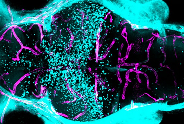 Výskumníci vstrekli fluorescenčné farbivo (modré) zebričkám s mutáciou génu, ktorá mení priepustnosť hematoencefalickej bariéry, čo spôsobuje únik krvi z ciev (ružové) len v určitých častiach mozgu.