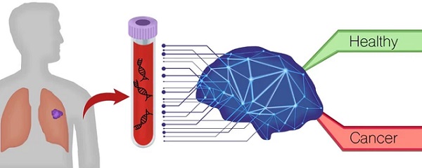 Krvný test DELFI identifikuje rakovinu pľúc pomocou umelej inteligencie, ktorá deteguje jedinečné vzorce fragmentácie DNA uvoľnenej z rakovinových buniek v porovnaní s normálnymi profilmi.