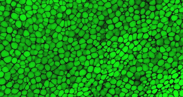 Lipochrupka pozorovaná v myšom uchu, pozostávajúca z husto uložených lipochondrocytov zafarbených zeleným fluorescenčným farbivom.