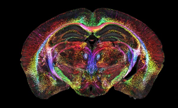 MRI a svetelná listová mikroskopia ponúkli nový pohľad do celého mozgu myši.