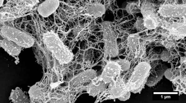 Snímka z rastrovacieho elektrónového mikroskopu zobrazuje baktérie E. coli uviaznuté v nanosieti. 