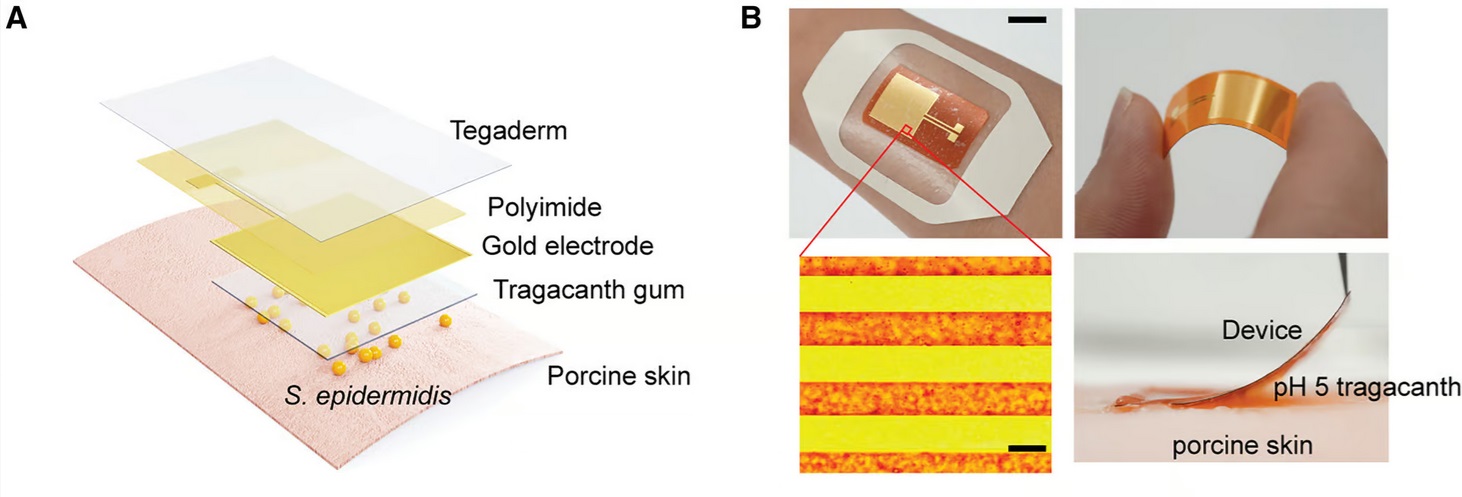 V rámci tejto štúdie bola bioelektronická náplasť aplikovaná na bravčovú kožu spolu s hydrogélom na vytvorenie kyslého prostredia pre excitabilitu baktérií.