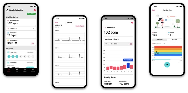 Sprievodná mobilná aplikácia prijíma údaje z CGM v reálnom čase.