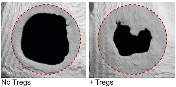 Regenerácia lebečnej kosti po injekcii hydrogélu s (vpravo) a bez (vľavo) Treg buniek. Červená prerušovaná čiara označuje veľkosť pôvodného defektu.