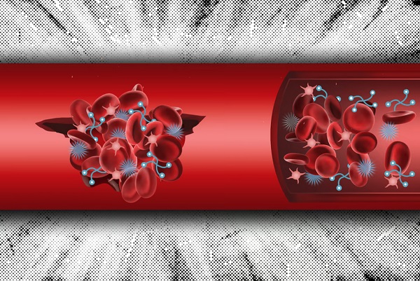 Umelecké stvárnenie syntetického systému, ktorý obsahuje dve zosieťované zložky, ktoré pomáhajú vytvárať krvné zrazeniny na zastavenie vnútorného krvácania.