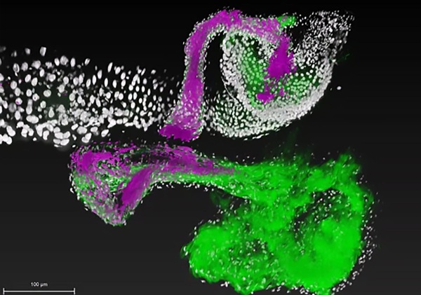 A beneficial bacteria (magenta) attaches to specific regions of the gut (green), colonizing it  The genes of the beneficial bacterial species Lactoplantibacillus (red) enable it to attach to a specific niche in the fruit fly gut (blue/cyan)  Engineering the gut microbiome just became a reality 3,889 / 5,000 Užitočné baktérie (purpurová) sa prichytia na špecifické oblasti čreva (zelené) a kolonizujú ich.