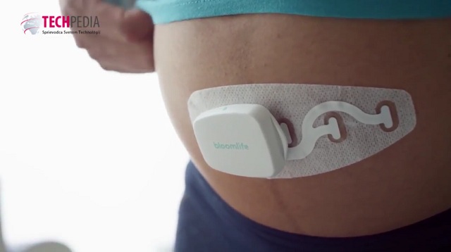 Bloomlife: Nositeľná technológia pre sledovanie svalových kontrakcií v maternici