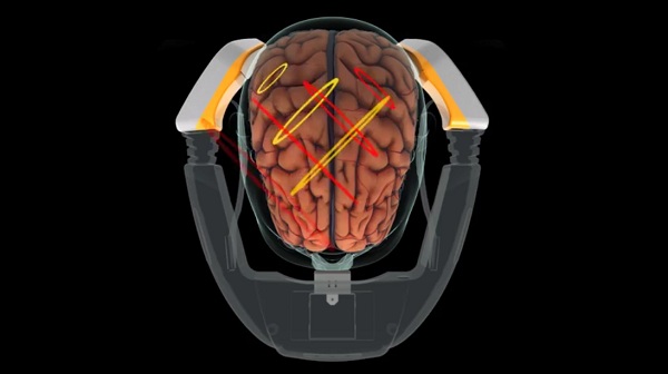 Prenosné zariadenie Cerebrotech Visor sa umiestni na hlavu pacienta a funguje tak, že vysiela nízkoenergetické rádiové vlny, ktoré prechádzajú ľavou a pravou hemisférou mozgu.