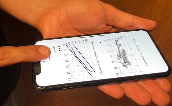 Prototyp mobilnej aplikácie využíva funkciu Apple Touch 3D pre meranie krvného tlaku používateľa.