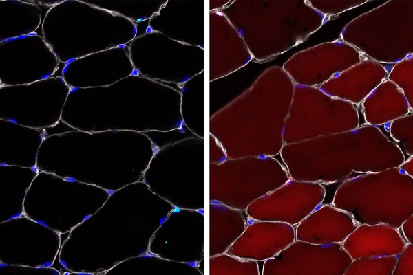 Vľavo sú bunky pred dodaním systému úpravy génov CRISPR. Pravá strana ukazuje na červeno žiariace bunky, čo indikuje úspešné doručenie upraveného génu.