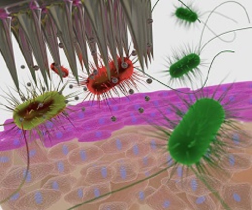 Ilustrácia zobrazuje náplasť s mikroihlami v akcii, ako nano častice striebra zabíjajú baktérie. 