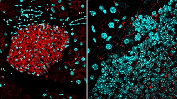 Vedci objavili biologickú bariéru, ktorá zabraňuje rakovinovým bunkám tvoriť nové nádory a čo je dôležitejšie, metastázovať.