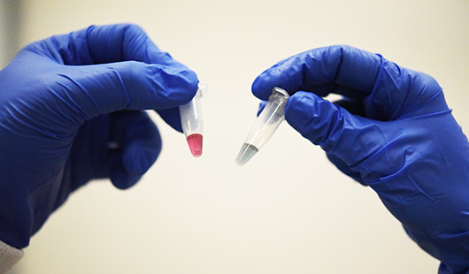 Nový objav vedie k rýchlemu a jednoduchému testu na zistenie všetkých druhov rakoviny z krvi alebo biopsie.