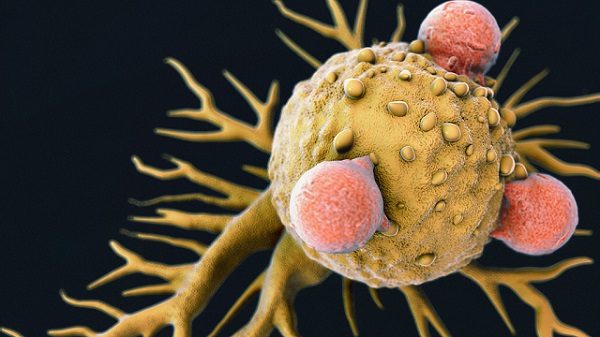 Novoobjavené imunitné T-bunky by mohli viesť k univerzálnej liečbe rakoviny.